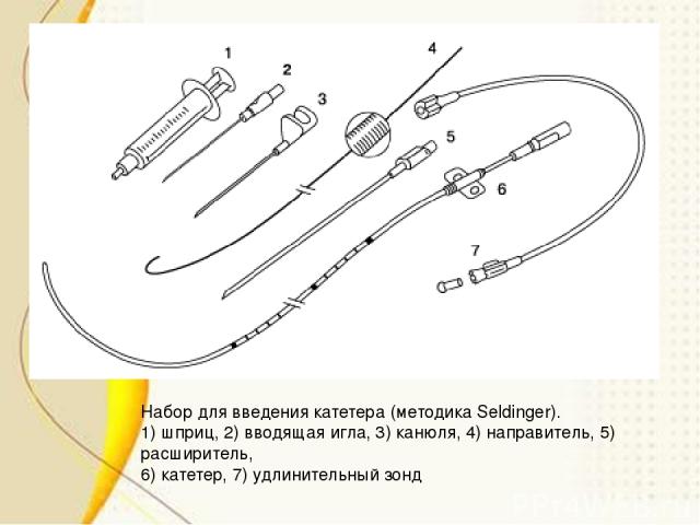 Набор для введения катетера (методика Seldinger). 1) шприц, 2) вводящая игла, 3) канюля, 4) направитель, 5) расширитель, 6) катетер, 7) удлинительный зонд