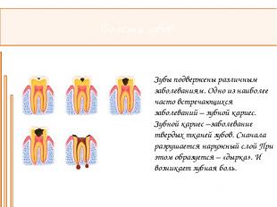 Болезни зубов: Зубы подвержены различным заболеваниям. Одно из наиболее часто вс