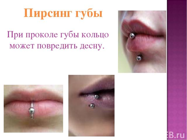 Пирсинг губы При проколе губы кольцо может повредить десну.