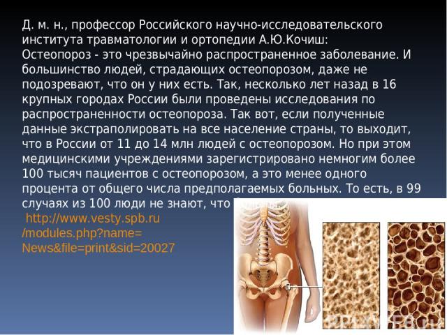 Д. м. н., профессор Российского научно-исследовательского института травматологии и ортопедии А.Ю.Кочиш: Остеопороз - это чрезвычайно распространенное заболевание. И большинство людей, страдающих остеопорозом, даже не подозревают, что он у них есть.…