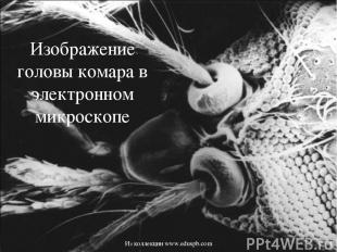 Изображение головы комара в электронном микроскопе Из коллекции www.eduspb.com И