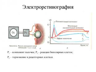 Электроретинография Р1 – компонент палочек; Р2 – реакция биполярных клеток; Р3 –