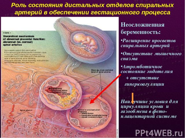 Роль состояния дистальных отделов спиральных артерий в обеспечении гестационного процесса Неосложненная беременность: Расширение просветов спиральных артерий Отсутствие мышечного спазма Атромботичное состояние эндотелия + отсутствие гиперкоагуляции …