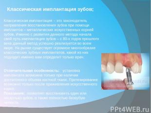 Классическая имплантация зубов; Классическая имплантация – это законодатель напр