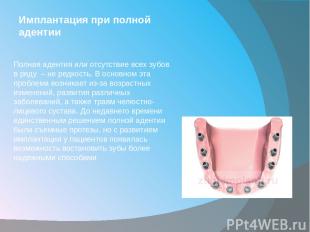 Имплантация при полной адентии Полная адентия или отсутствие всех зубов в ряду 