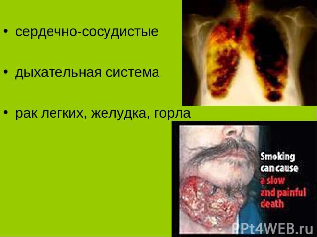 Заболевания курильщиков сердечно-сосудистые дыхательная система рак легких, желудка, горла