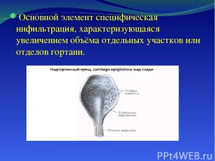 Основной элемент специфическая инфильтрация, характеризующаяся увеличением объём