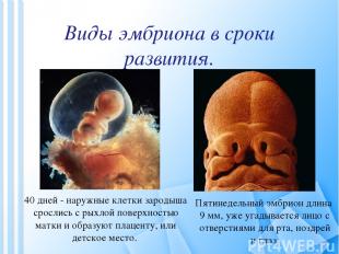 Виды эмбриона в сроки развития. Пятинедельный эмбрион длина 9 мм, уже угадываетс