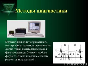 Методы диагностики DenScan позволяет обрабатывать электрофореграммы, полученные