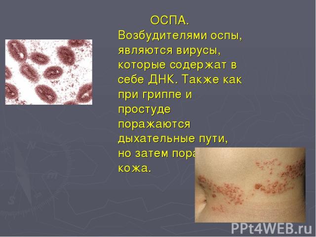 ОСПА. Возбудителями оспы, являются вирусы, которые содержат в себе ДНК. Также как при гриппе и простуде поражаются дыхательные пути, но затем поражается кожа.