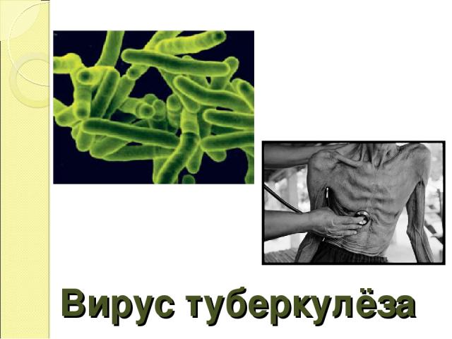 Вирус туберкулёза