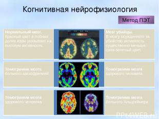 Когнитивная нейрофизиология Метод ПЭТ Нормальный мозг. Красный цвет в лобных дол