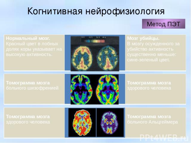 Когнитивная нейрофизиология Метод ПЭТ Нормальный мозг. Красный цвет в лобных долях коры указывает на высокую активность. Мозг убийцы. В мозгу осужденного за убийство активность существенно меньше: сине-зеленый цвет. Томограмма мозга  больного шизофр…