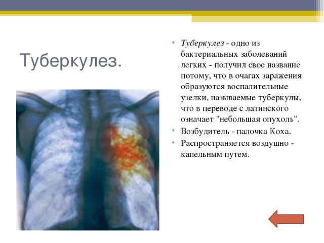 Туберкулез. Туберкулез - одно из бактериальных заболеваний легких - получил свое название потому, что в очагах заражения образуются воспалительные узелки, называемые туберкулы, что в переводе с латинского означает 