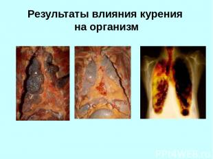Результаты влияния курения на организм