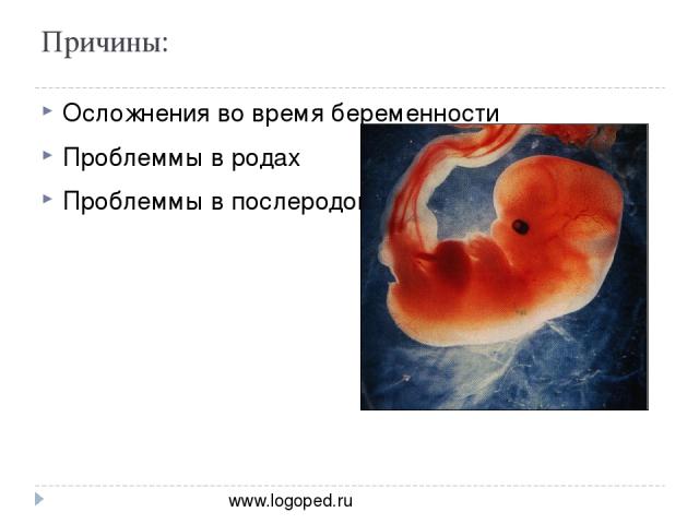 Причины: Осложнения во время беременности Проблеммы в родах Проблеммы в послеродовом периоде www.logoped.ru