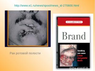 Рак ротовой полости http://www.e1.ru/news/spool/news_id-270800.html