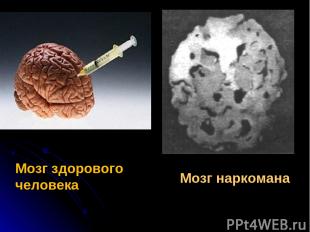 Мозг наркомана Мозг здорового человека