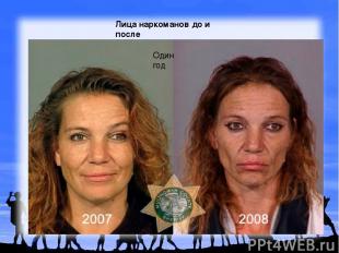 Лица наркоманов до и после Один год