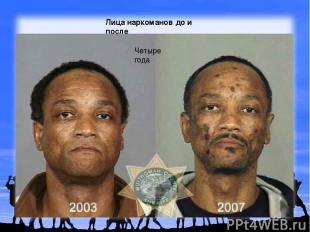 Лица наркоманов до и после Четыре года