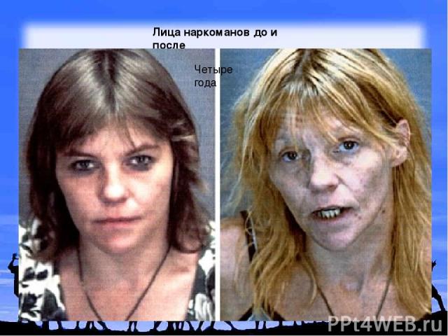 Лица наркоманов до и после Четыре года