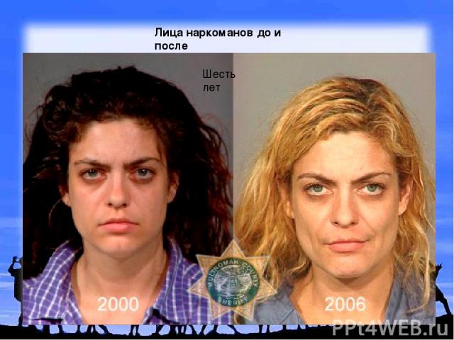 Лица наркоманов до и после Шесть лет