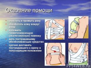 Оказание помощи очистить и промыть рану обработать кожу вокруг раны наложить гер