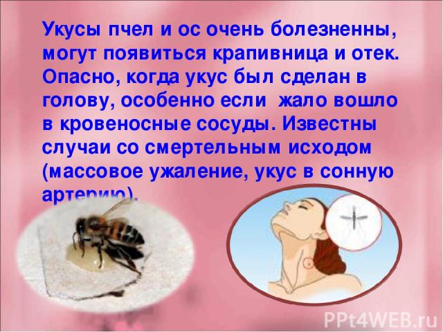 Укусы пчел и ос очень болезненны, могут появиться крапивница и отек. Опасно, когда укус был сделан в голову, особенно если  жало вошло в кровеносные сосуды. Известны случаи со смертельным исходом (массовое ужаление, укус в сонную артерию).