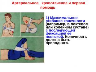 Артериальное кровотечение и первая помощь 1) Максимальное сгибание конечности (н