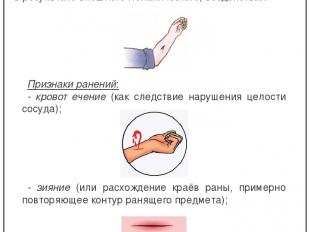 Ранение (рана) – любое нарушение целости кожных покровов и подлежащих тка ней (в