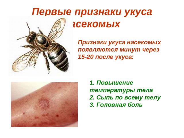 Первые признаки укуса насекомых Признаки укуса насекомых появляются минут через 15-20 после укуса: 1. Повышение температуры тела 2. Сыпь по всему телу 3. Головная боль