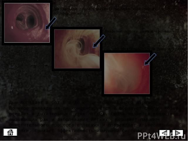 Эти 4 снимка показывают быстрое распространение опухоли в легких одного и того же пациента. На последнем снимке (22 апреля) видно быстрое увеличение массы с заметным развитием процесса в правом легком. Не все опухоли легкого развиваются настолько бы…