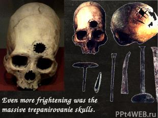 Even more frightening was the massive trepanirovanie skulls.