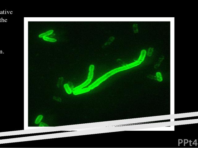 Yersinia pestis The causative agent of the plague is Yersinia pestis bacterium.