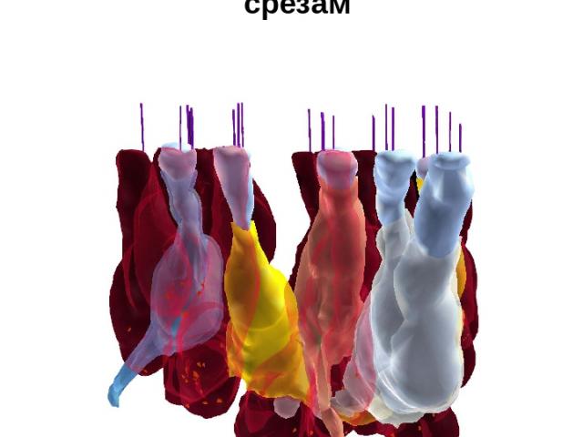 Пример эмпирической реконструкции 3-D структуры эпителия вестибулярного аппарата крысы по серийным срезам