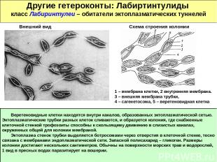 Другие гетероконты: Лабиртинтулиды класс Лабиринтулеи – обитатели эктоплазматиче
