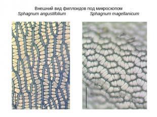 Внешний вид филлоидов под микроскопом Sphagnum angustifolium Sphagnum magellanic