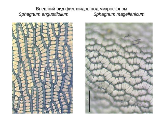 Внешний вид филлоидов под микроскопом Sphagnum angustifolium Sphagnum magellanicum