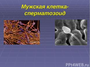 Мужская клетка-сперматозоид