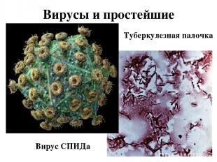 Вирусы и простейшие Вирус СПИДа Туберкулезная палочка