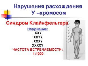 Нарушения расхождения У –хромосом Синдром Клайнфельтера Нарушение: XXY XXYY XXXY