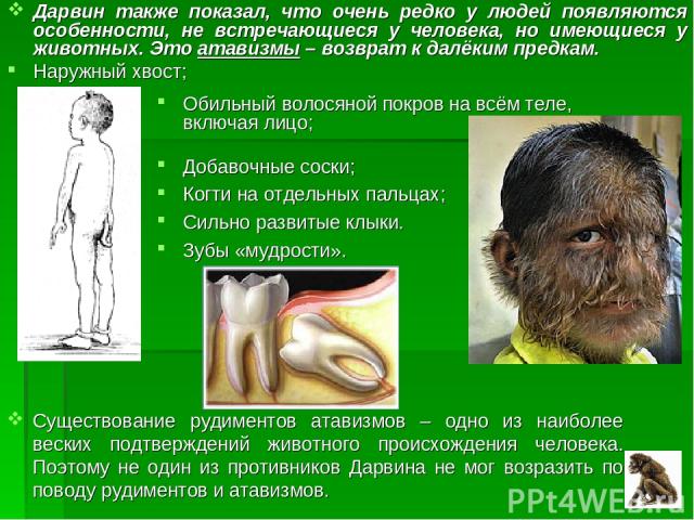 Дарвин также показал, что очень редко у людей появляются особенности, не встречающиеся у человека, но имеющиеся у животных. Это атавизмы – возврат к далёким предкам. Наружный хвост; Обильный волосяной покров на всём теле, включая лицо; Добавочные со…