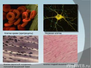 Клетки крови (эритроциты) Нервная клетка Клетки скелетной поперечно-полосатой мы