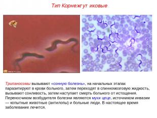 Трипаносомы вызывают «сонную болезнь», на начальных этапах паразитируют в крови