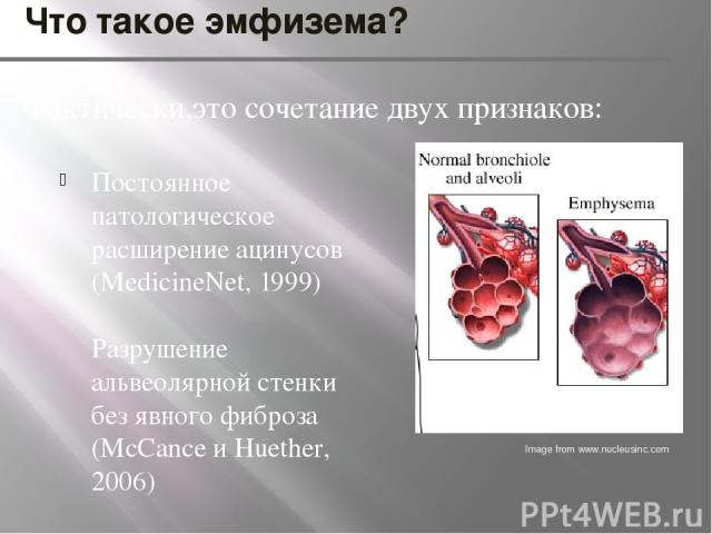 Что такое эмфизема? Постоянное патологическое расширение ацинусов (MedicineNet, 1999) Разрушение альвеолярной стенки без явного фиброза (McCance и Huether, 2006) Фактически,это сочетание двух признаков: Image from www.nucleusinc.com