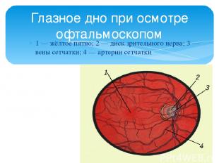 1 — жёлтое пятно; 2 — диск зрительного нерва; 3 — вены сетчатки; 4 — артерии сет