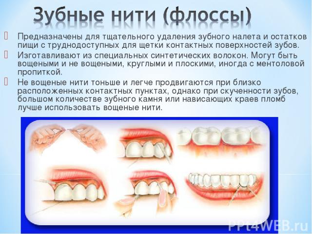 Предназначены для тщательного удаления зубного налета и остатков пищи с труднодоступных для щетки контактных поверхностей зубов. Изготавливают из специальных синтетических волокон. Могут быть вощеными и не вощеными, круглыми и плоскими, иногда с мен…