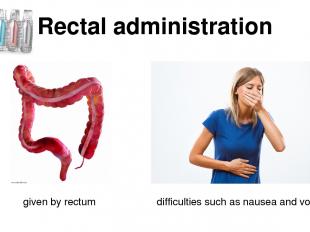 Rectal administration given by rectum difficulties such as nausea and vomiting