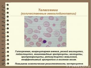 Талассемии (количественные гемоглобинопатии)