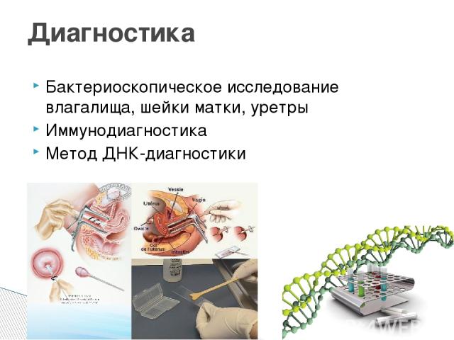 Бактериоскопическое исследование влагалища, шейки матки, уретры Иммунодиагностика Метод ДНК-диагностики Диагностика